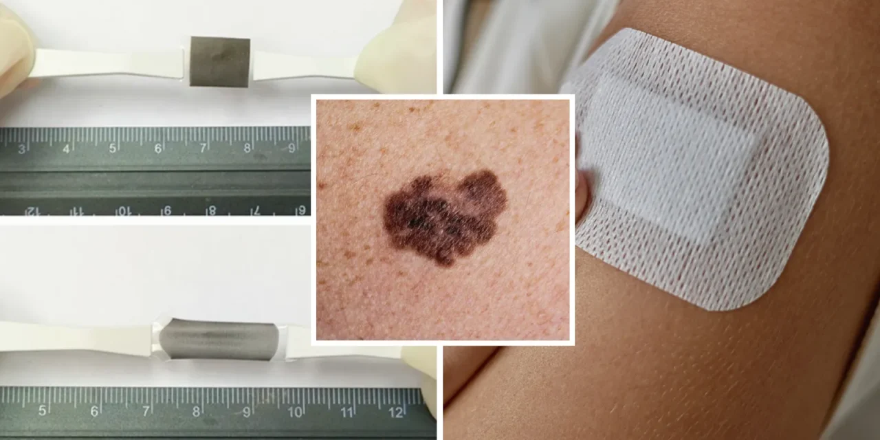 Heat-Activated Patch Kills Deadly Skin Cancer Cells Without Surgery