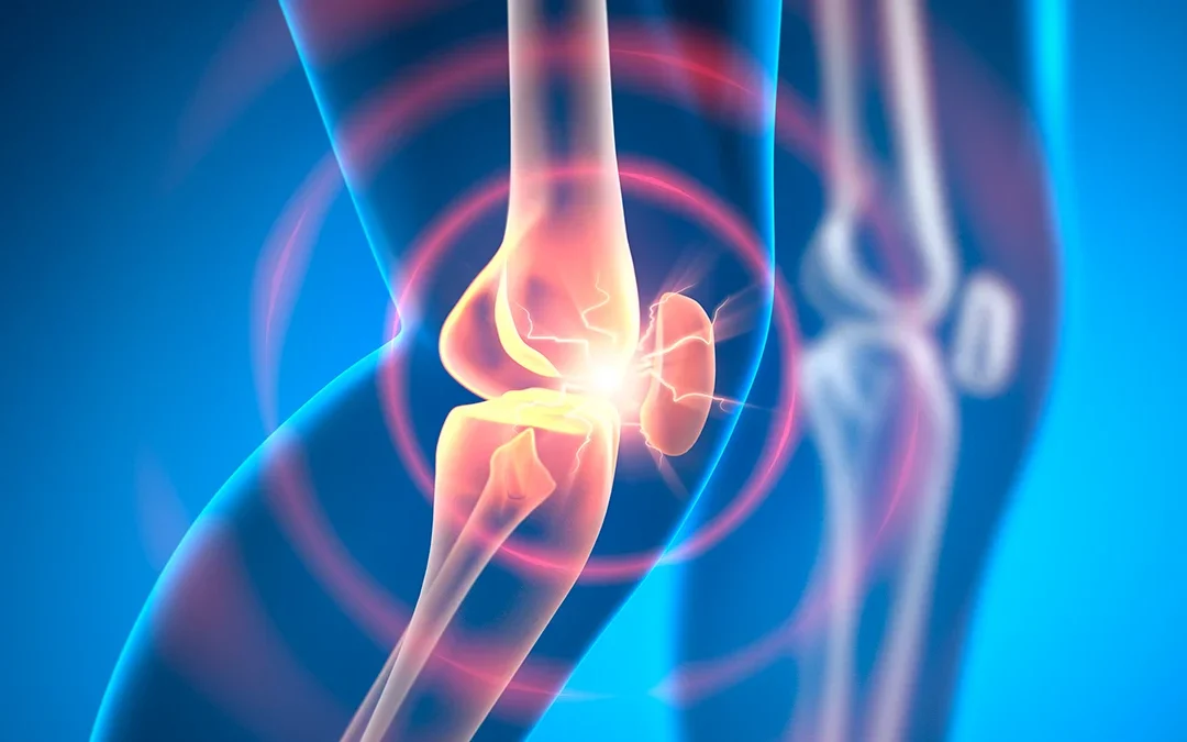 Experimental Drug Can Reverse Osteoarthritis in Weeks, Animal Research Shows