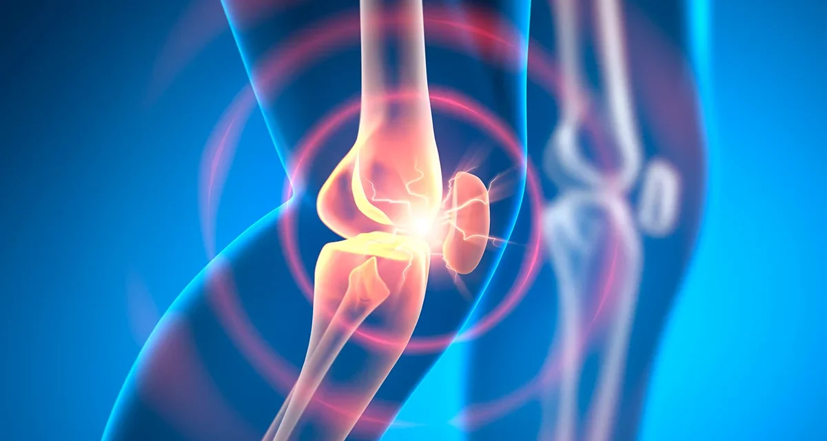 Experimental Drug Can Reverse Osteoarthritis in Weeks, Animal Research Shows