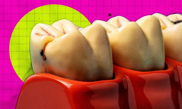 Plans Accelerated for Human Trials of Tooth Regeneration