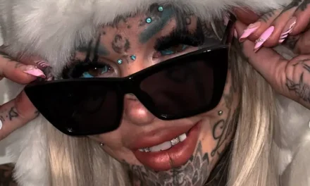 ‘Most tattooed woman’ posts first post-op photos after flying 21 hours for ‘highly illegal’ surgery