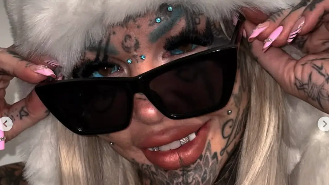 ‘Most tattooed woman’ posts first post-op photos after flying 21 hours for ‘highly illegal’ surgery
